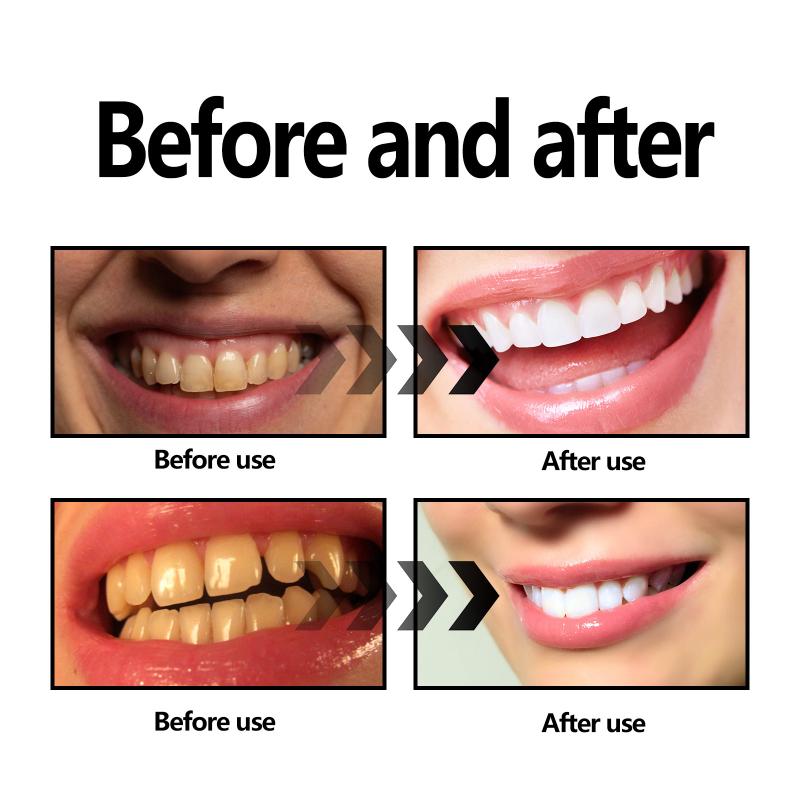 Teeth Whitening Powder Charcoa - Whitening Teeth Using Baking Soda ulasan dan harga
