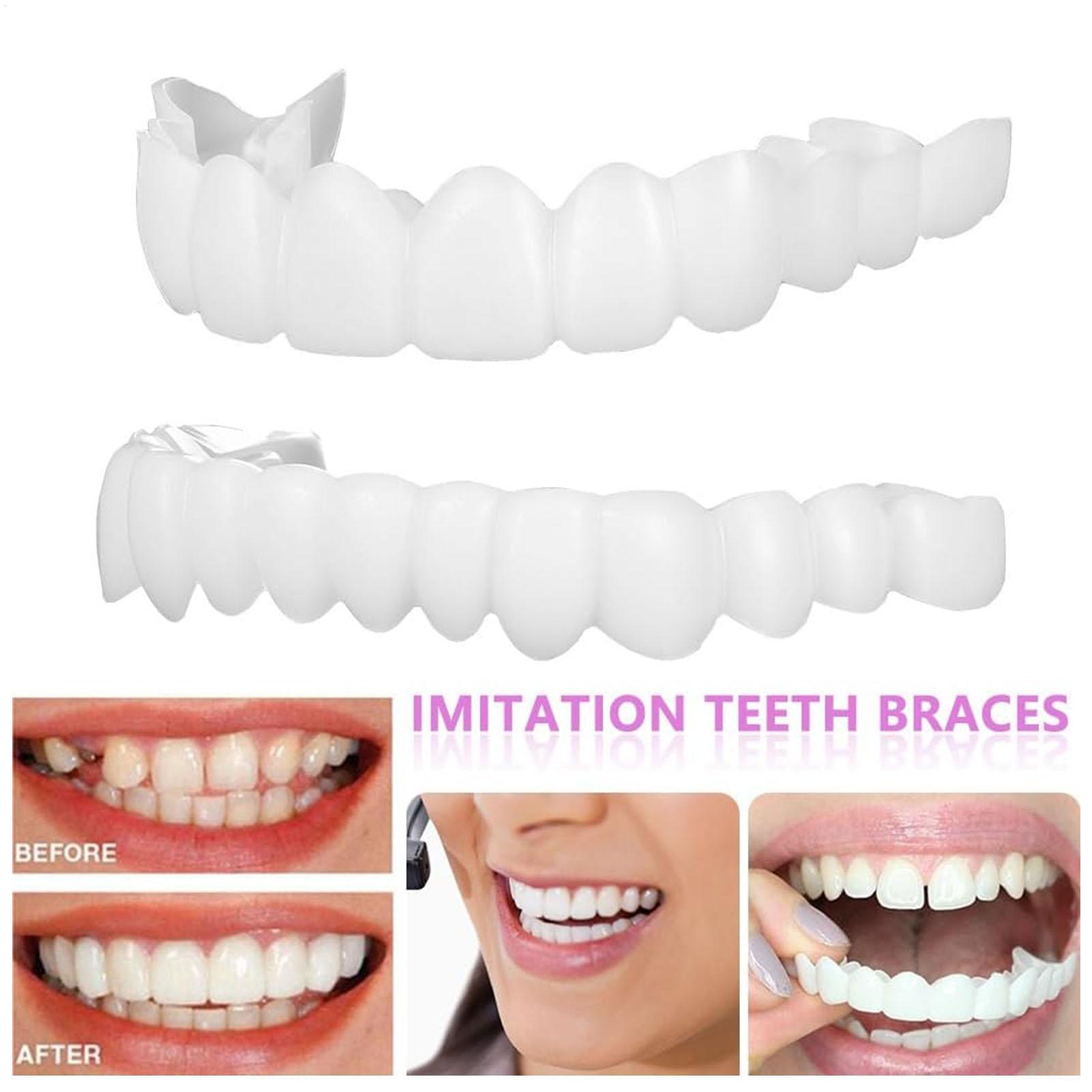 Dental Upper Lower Fake Teeth  - Teeth Whitening In Office ulasan dan harga