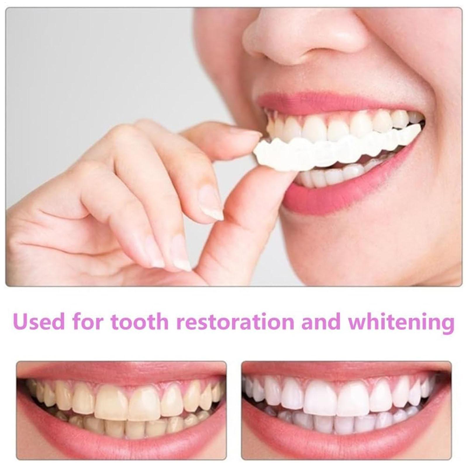 Dental Upper Lower Fake Teeth  - Teeth Whitening In Office ulasan dan harga