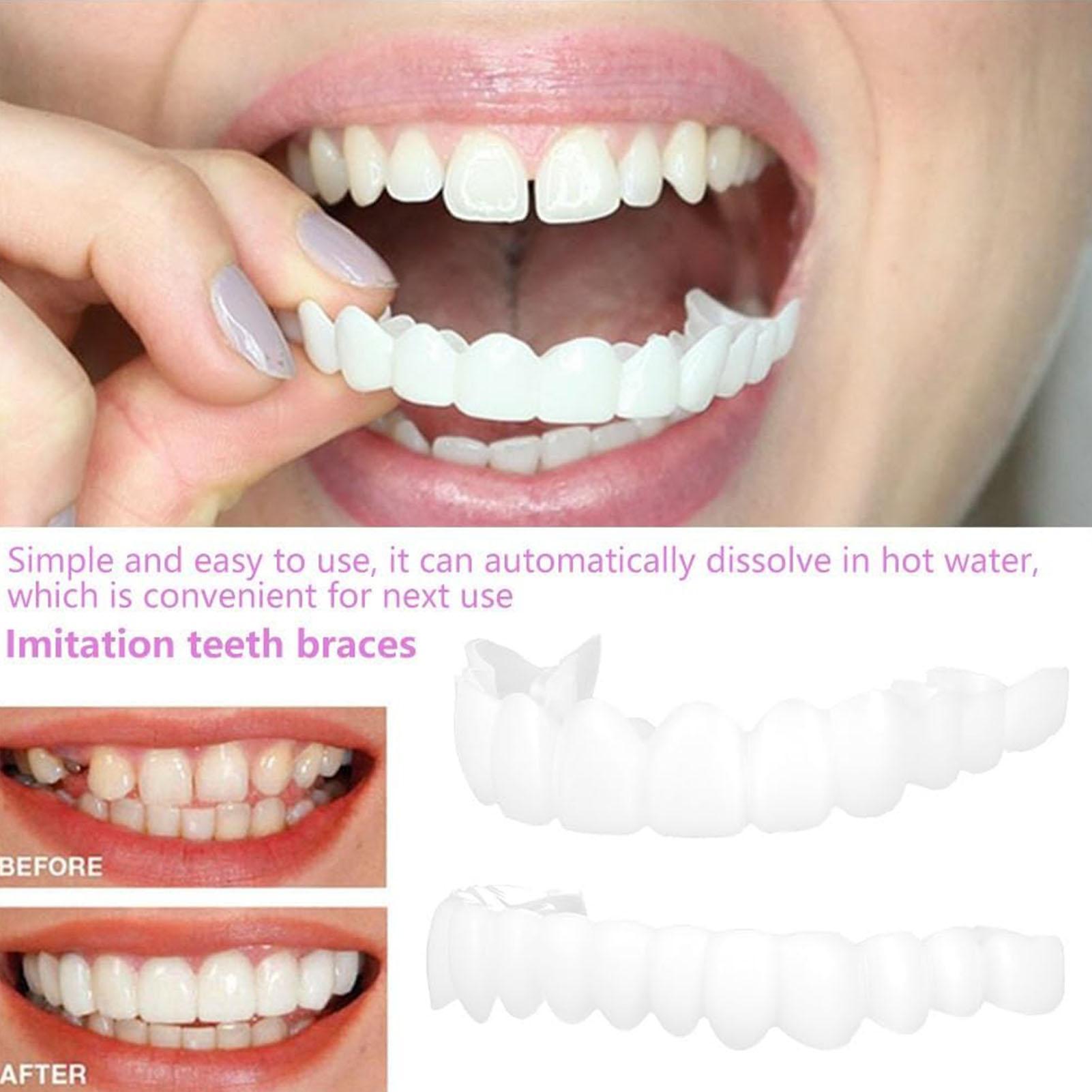 Dental Upper Lower Fake Teeth  - Teeth Whitening In Office ulasan dan harga