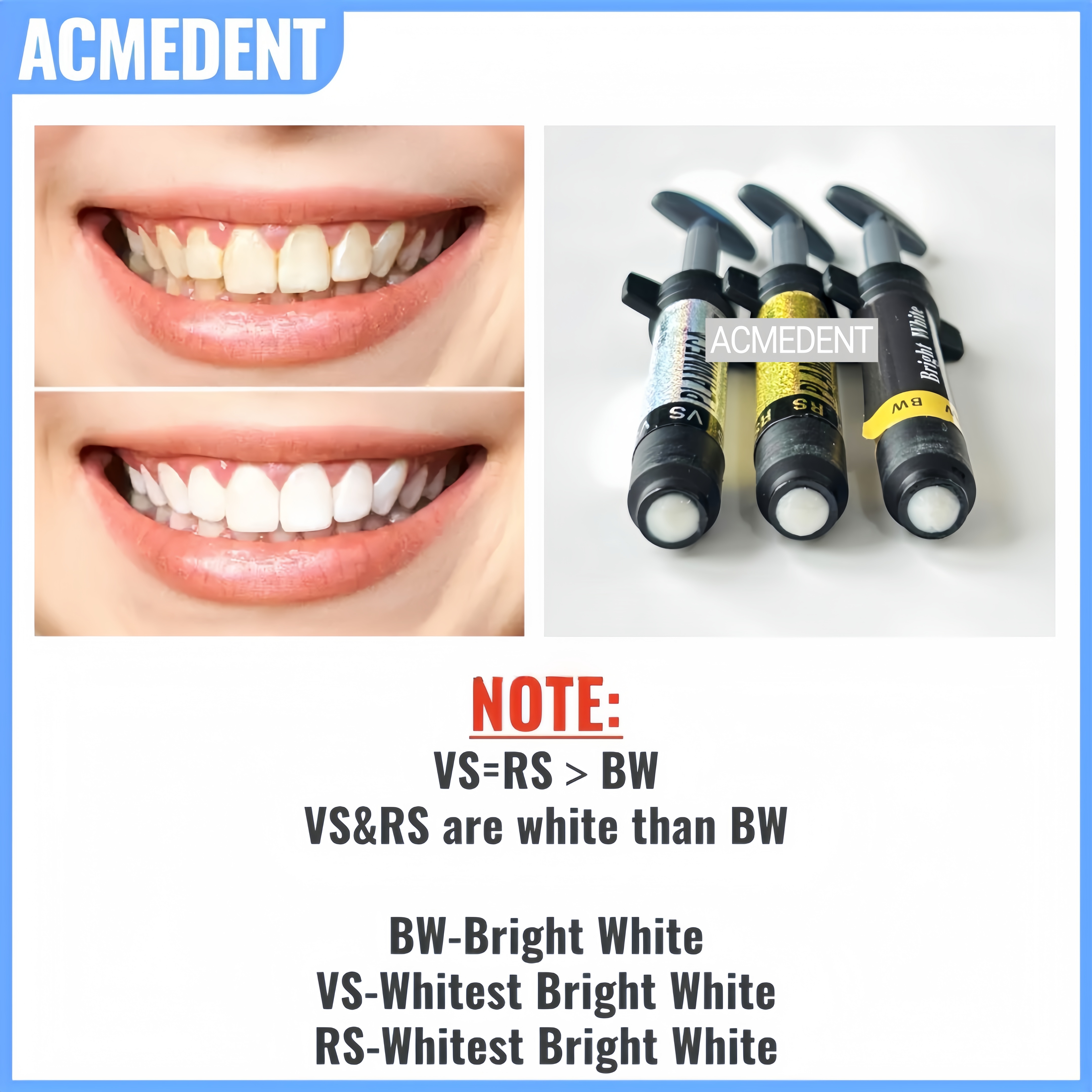 4.5g VS Dental Light Cure Hybr - Teeth Whitening Vs Veneers ulasan dan harga