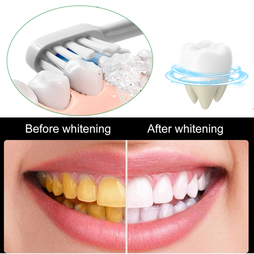 Useful Toothpaste Prevent And  - Whitening Teeth Using Baking Soda ulasan dan harga
