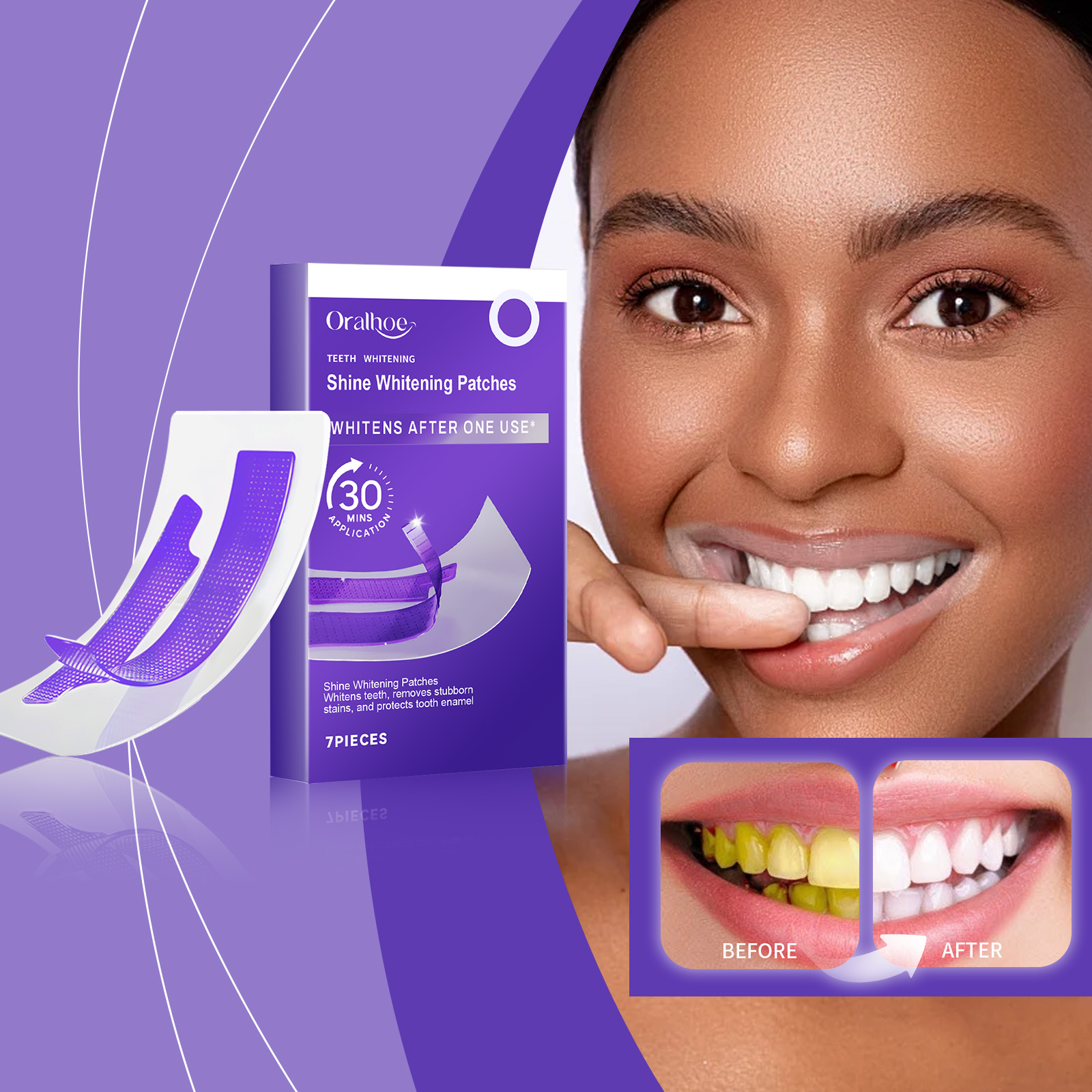 Purple Teeth Whitening Strips  - Teeth Whitening Street ulasan dan harga