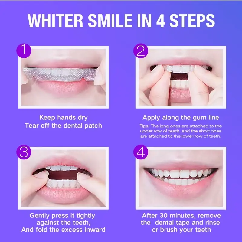 Teeth Whitening Kit - 5X LED L - Teeth Whitening Street ulasan dan harga