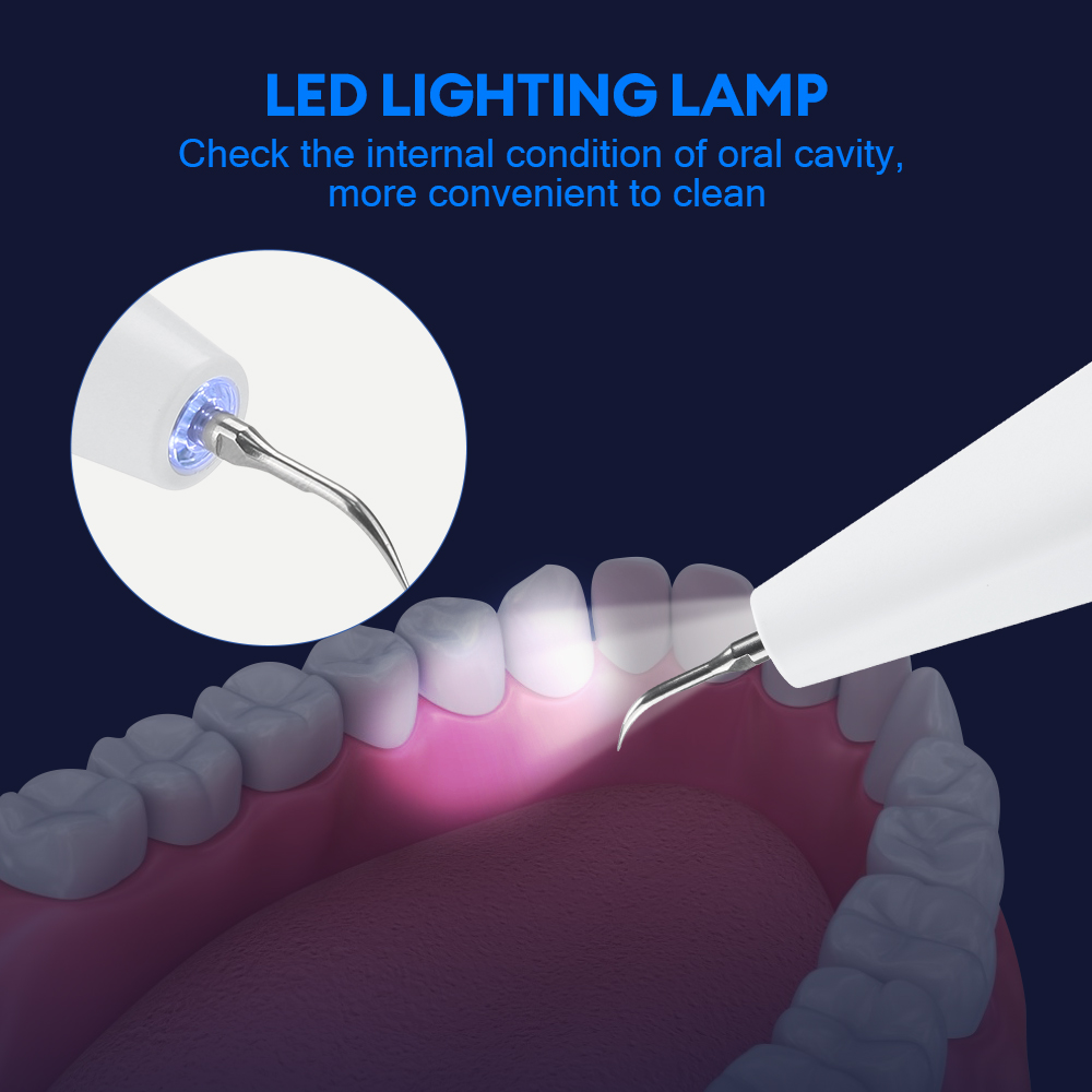 Ultrasonic Dental Calculus Rem - Teeth Whitening Retainer ulasan dan harga