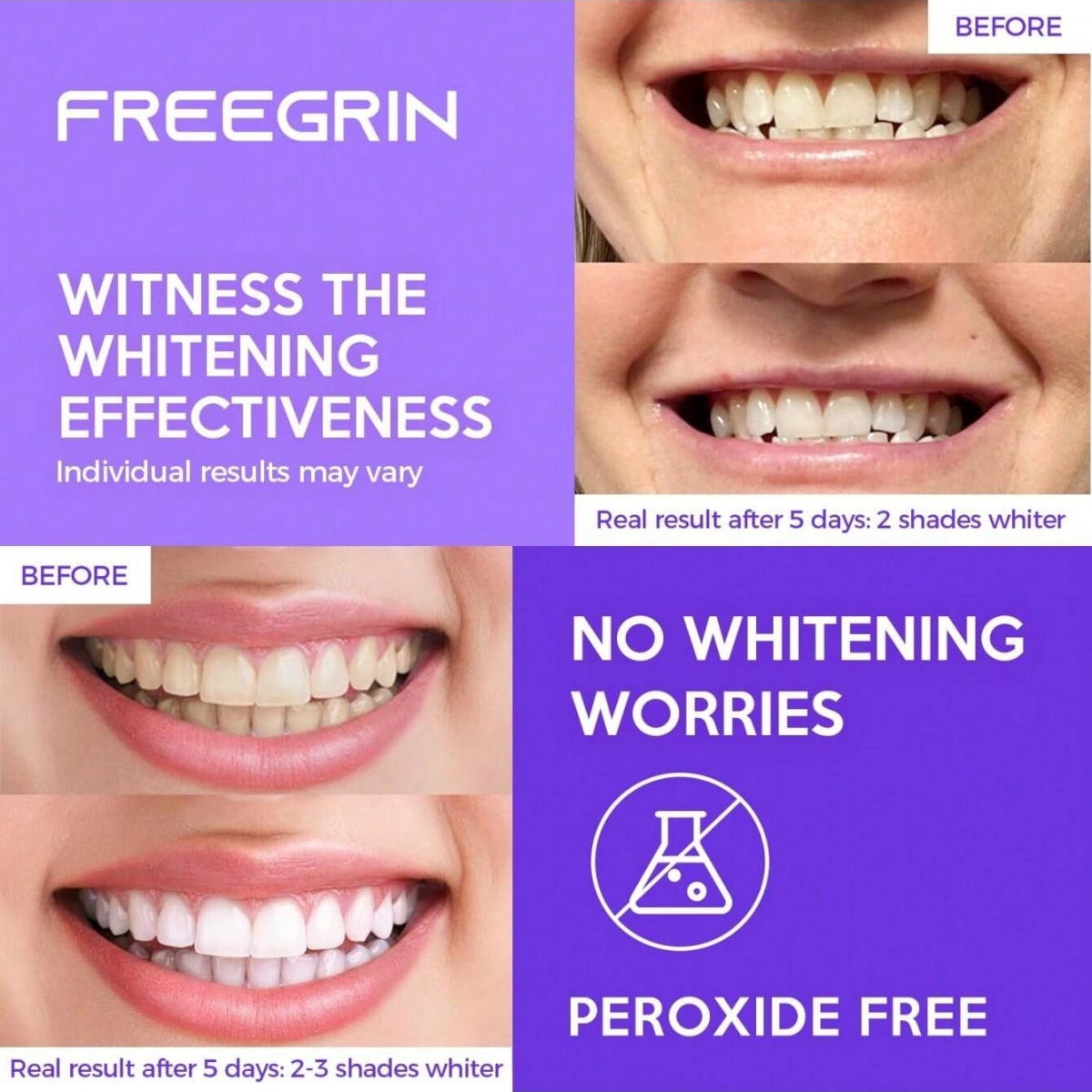 Deluxe Whitening Teeth Sticker - Teeth Whitening In Office ulasan dan harga