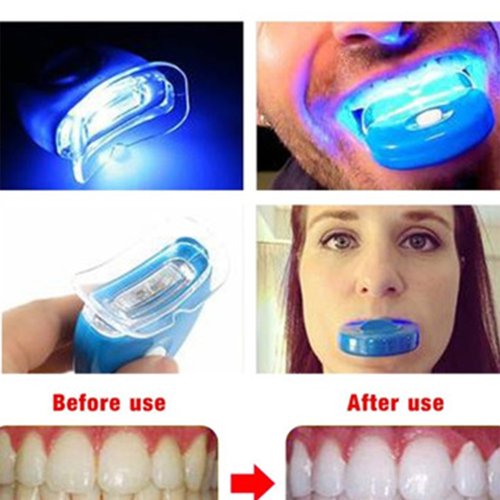 New Blue Led Teeth Whitening A - Teeth Whitening In Office ulasan dan harga