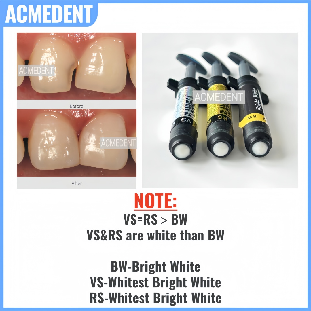 4.5g Dental Composite Resin Ve - Teeth Whitening Vs Veneers ulasan dan harga