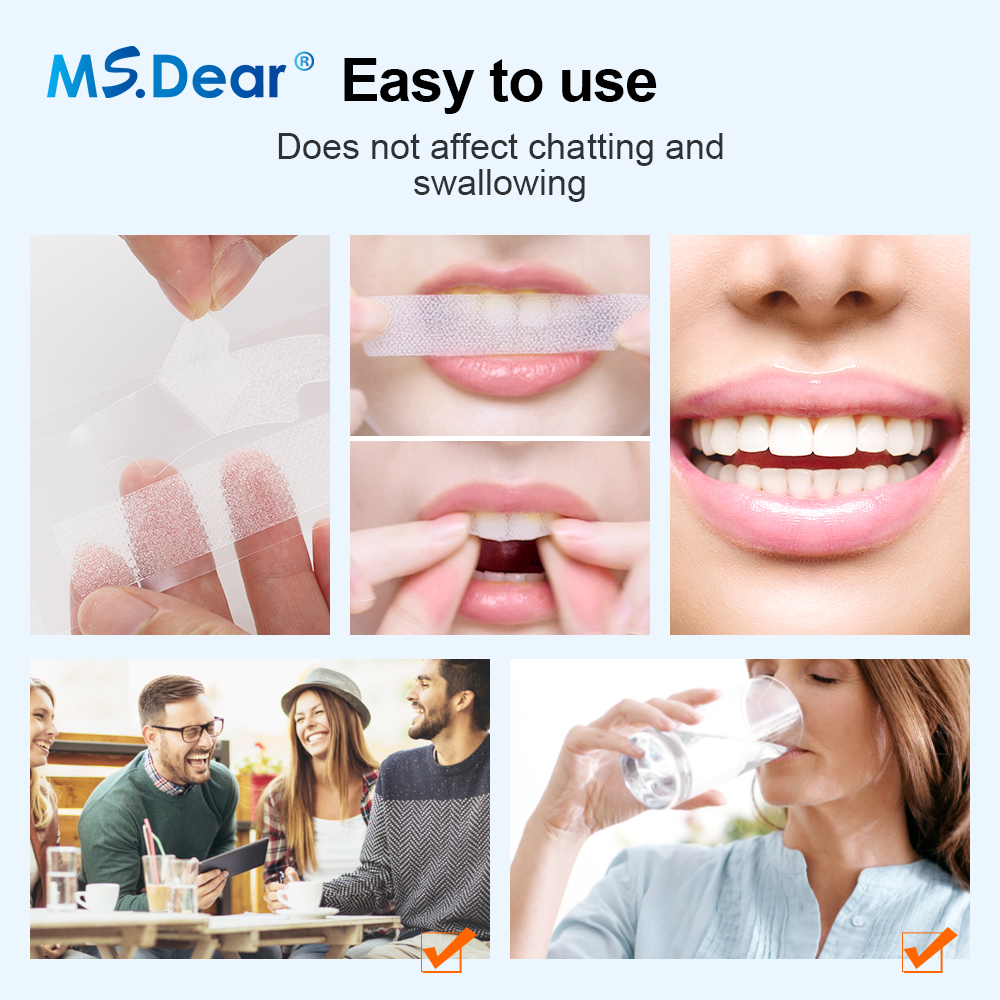Teeth Whitening Strips Cleansi - Teeth Whitening Street ulasan dan harga